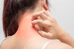 Dermatology Conditions