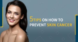 5 Tips on How to Prevent Skin Cancer New