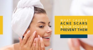 What Causes Acne Scars and How You Can Prevent Them New