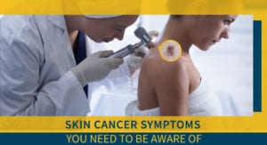 Skin Cancer Symptoms You Need To Be Aware Of
