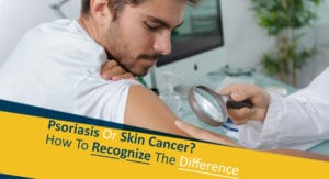 Psoriasis Or Skin Cancer