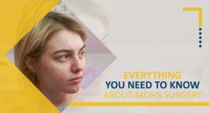 Everything You Need to Know About Mohs Surgery
