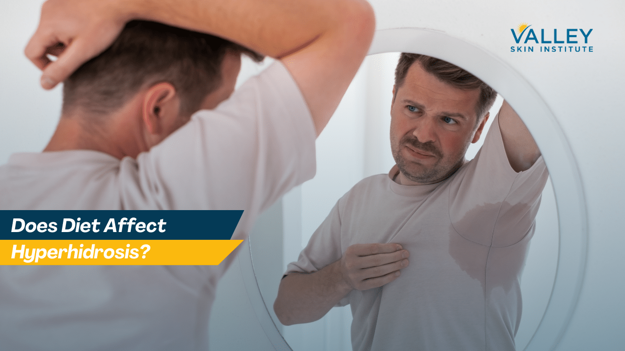 Does Diet Affect Hyperhidrosis